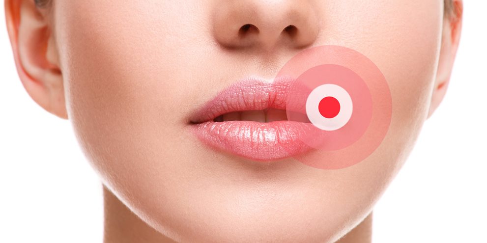 Cold clearance sore lip
