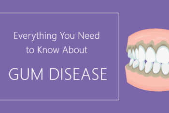 Salt Lake City dentist, Dr. Brickey at Natural Smiles Dentistry, talks about the important facts about gum disease that you should know about.