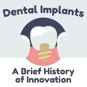 Salt Lake City dentist, Dr. Thomas Brickey of Natural Smiles Dentistry discusses dental implants and shares some information about their history.