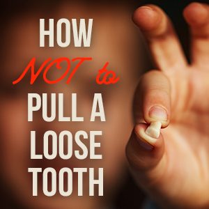 Salt Lake City dentist, Dr. Thomas Brickey at Natural Smiles Dentistry, tells parents the do’s and don’ts of pulling your child’s loose baby teeth for the safest and most painless experience.