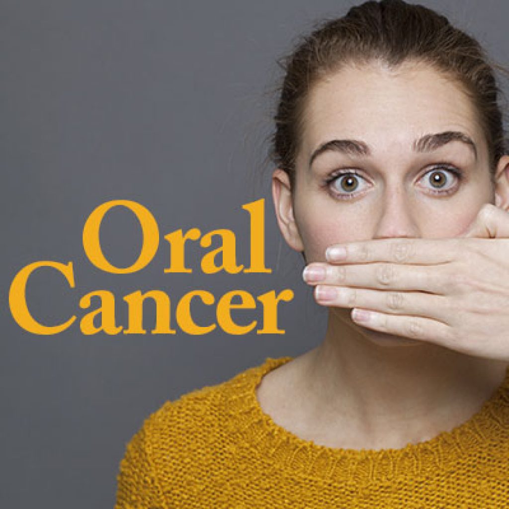 Prevention Of Oral Cancer In Salt Lake City Natural Smiles Dentistry