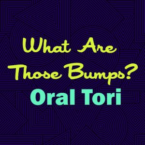 Salt Lake City dentist, Dr. Thomas Brickey at Natural Smiles Dentistry explains oral tori—what they are, why they happen, and whether they are a cause for concern.