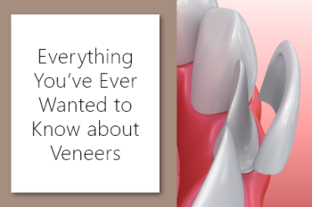 Salt Lake City dentist, Dr. Brickey at Natural Smiles Dentistry, shares everything you may want to know about veneers.