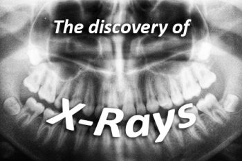 Salt Lake City dentist, Dr. Brickey at Natural Smiles Dentistry, discusses the discovery of X-rays and how they have advanced over the years.