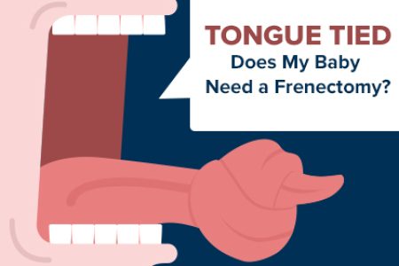 Tongue Tied: Does My Baby Need a Frenectomy?