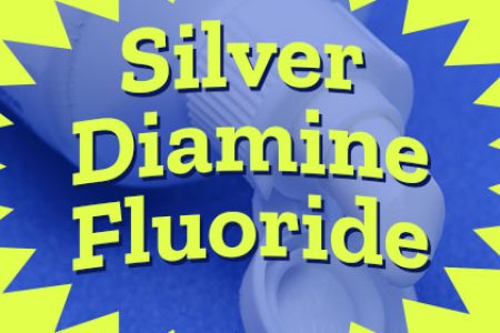 Silver Diamine Fluoride: An Affordable Filling Alternative